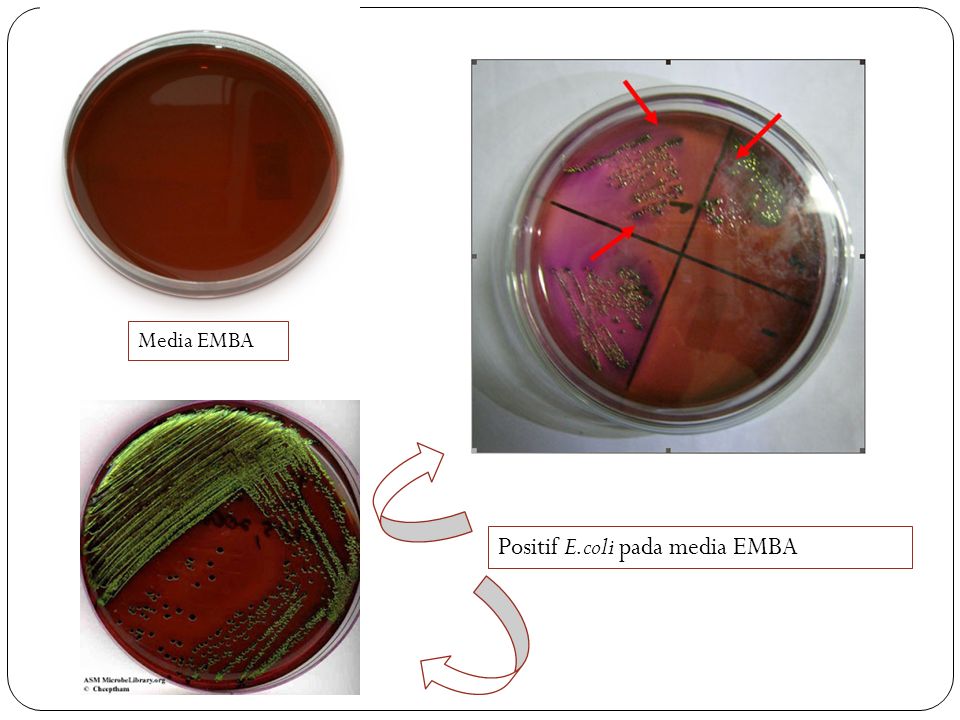 Media EMBA Positif E.coli pada media EMBA