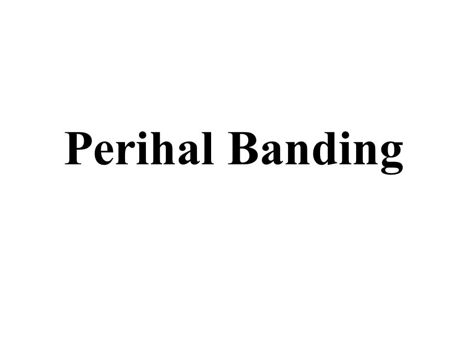 Perihal Banding