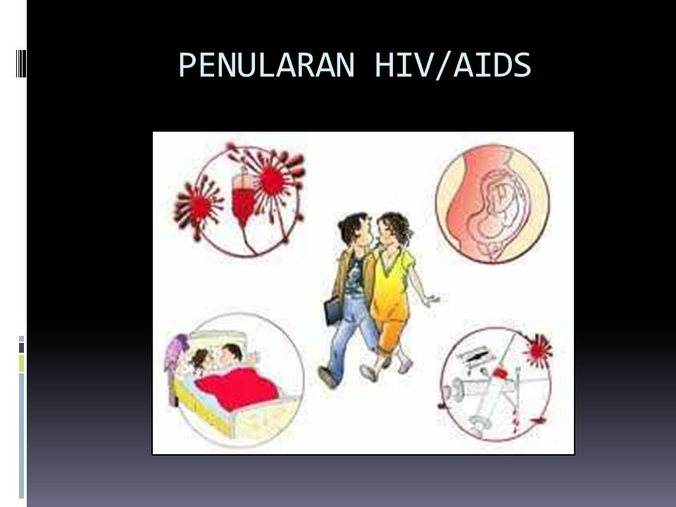 PENULARAN HIV/AIDS