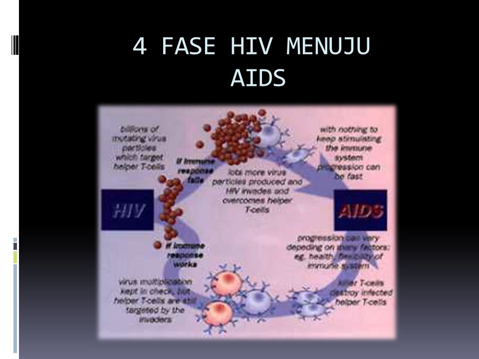 4 FASE HIV MENUJU AIDS