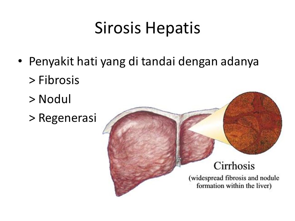 Hepatis перевод с латинского