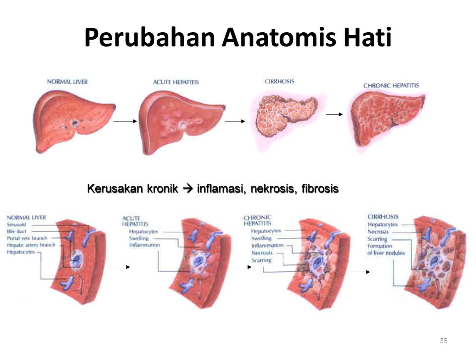 Hepatis перевод с латинского